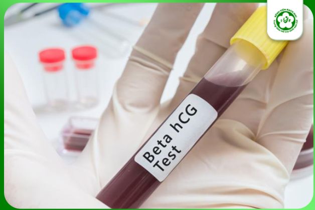 Xét nghiệm máu về nồng độ beta HCG để biết kết quả mang thai