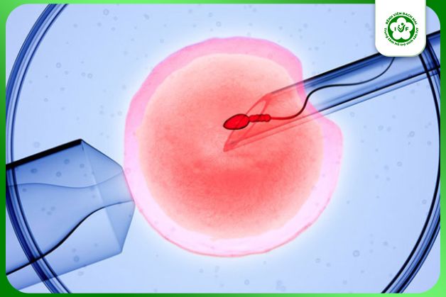 Thụ tinh ống nghiệm (IVF) là phương pháp hỗ trợ sinh sản hiện đại