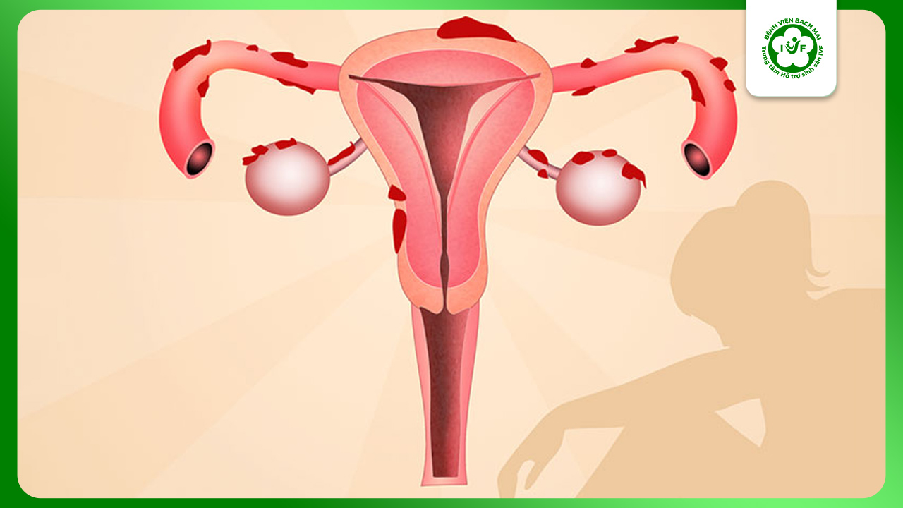 Niêm mạc tử cung đóng vai trò quan trọng đối với quá trình thụ thai và mang thai 
