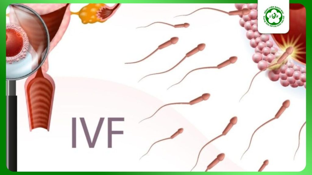Làm IVF: Thông tin nhất định phải biết khi điều trị hiếm muộn
